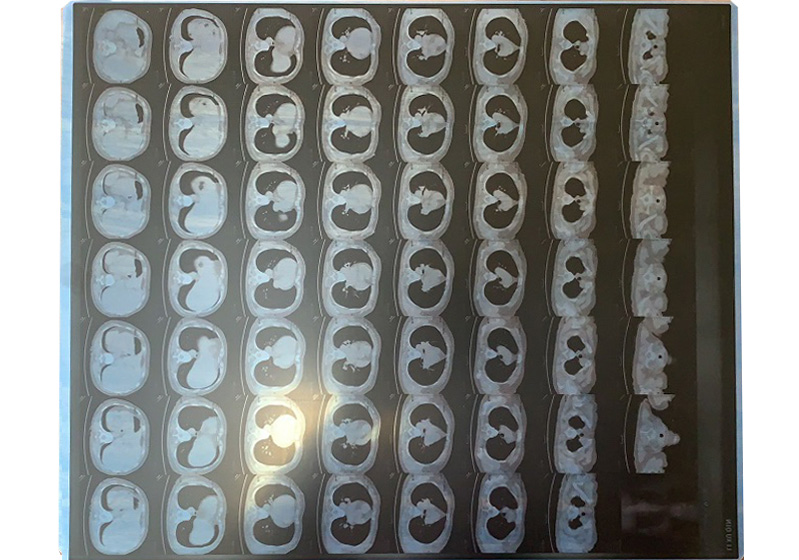 �t(y��)�ø�ʽ�zƬ-�����zƬ