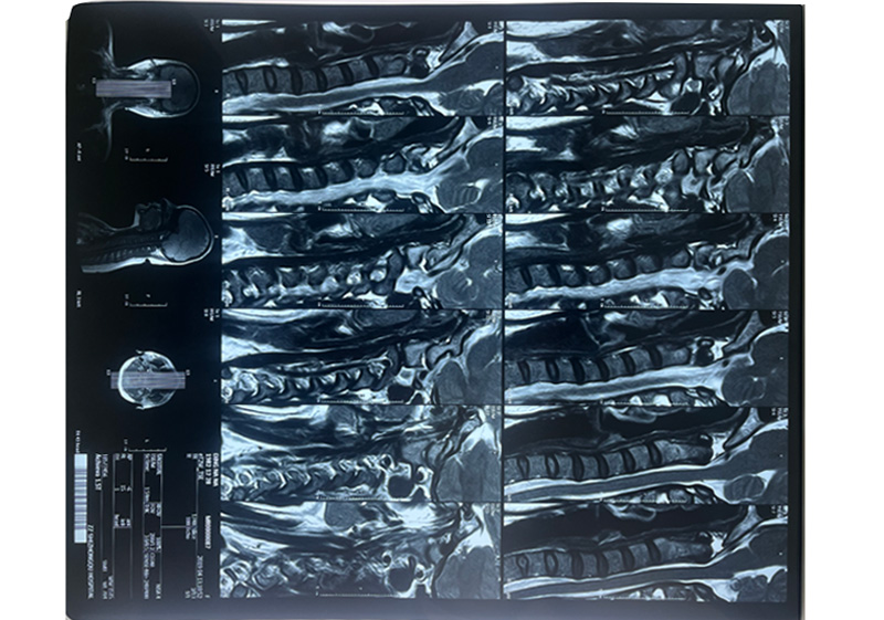 �t(y��)�ø�ʽ�zƬ-�t�⼤���zƬ