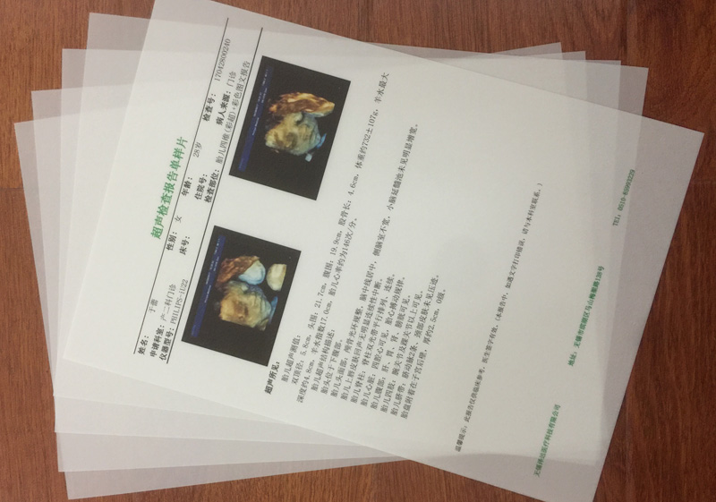 ����ɰ�Ƭ��θ�c�R��