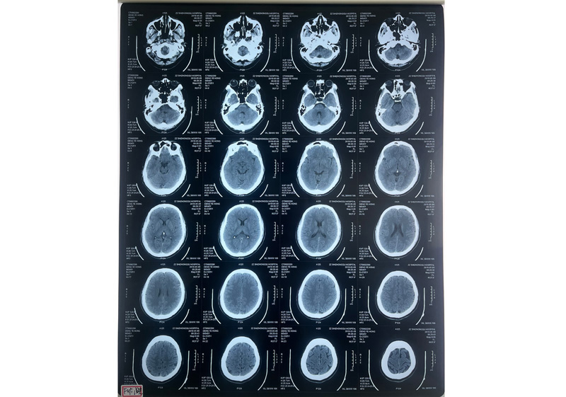 �t(y��)�ø�ʽ�zƬ-�t�⼤���zƬ